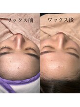 ジョワ アイラッシュサロン(joie)/効果がすごい！！