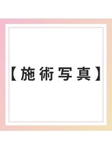 ブレア 銀座/施術写真【自律神経/虎ノ門/鍼】