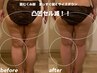 《人気No.1☆本気痩身》セル脂肪をどうにかしたい方 18000円→9980円 45分