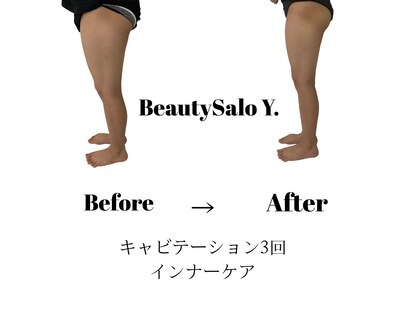 ワイドット(Y.)の写真