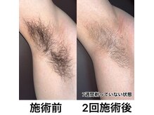 サンスタイルクリア 守山店(SUN STYLE CLEAR)