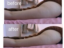 イーリバイブ/iNVYDOM MAX