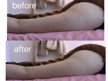 イーリバイブ/iNVYDOM MAX