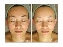 アン グレーヌ 自由が丘(unegraine)/ひと皮むけたような艶やかさ！