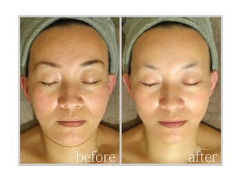 アン グレーヌ 自由が丘(unegraine)/ひと皮むけたような艶やかさ！