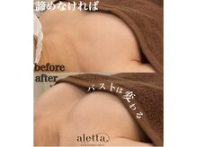 アレッタ(aletta.)