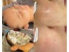 【乾燥/リフトアップ/繰返すシミ】繰返す肌トラブルリセットフェイシャル90分