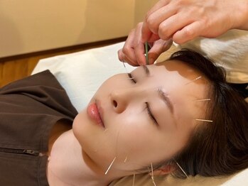 鍼灸ハウス(鍼灸house)の写真/【結果重視に拘る】《その場しのぎではなく》根本の不調をピンポイントで改善します。