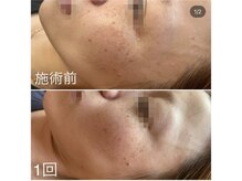 セメヴェール(Saimervell)の雰囲気（※反応の出方は個人差がございます。）