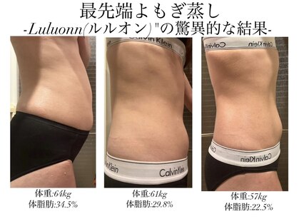 ヨサパーク 美世(YOSA PARK bize)の写真