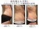 ヨサパーク 美世(YOSA PARK bize)の写真