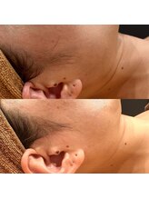 シノ 銀座(shino)/美しいもみあげへ