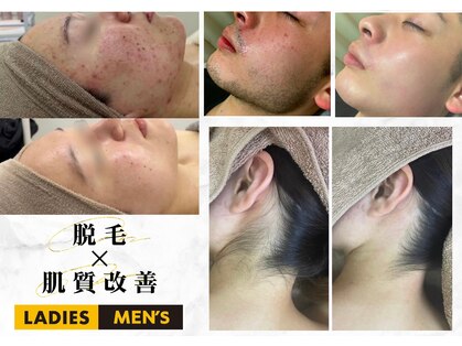 アルゴ 八幡黒崎店(ALGO)の写真