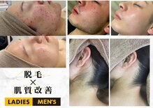 アルゴ 八幡黒崎店(ALGO)