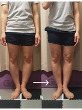 プラスファイン(+fine)/O脚矯正！