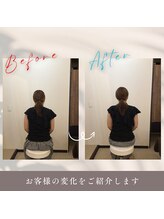 アルク美容整体院(ARUKU美容整体院)/“頭痛・めまい”根本から改善！