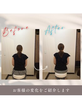 アルク美容整体院(ARUKU美容整体院)/“頭痛・めまい”根本から改善!