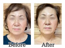 ハナハナ(hanahana)/