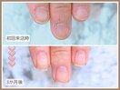 【自爪育成コース】