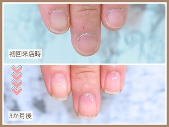 ルシェルアイ/【自爪育成コース】