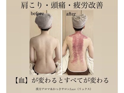 リュクス(Luxe)の写真