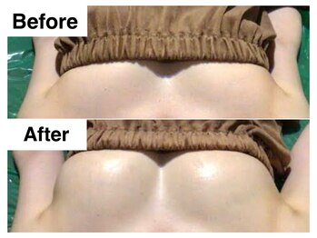 ナトゥーラ チュチュ(natura chuchu)/ふっくらマシュマロバスト★梅田