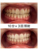 エム(M)/１回の変化！！