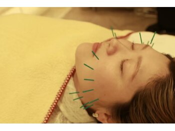 リボディ美容鍼灸院(Re±body美容鍼灸院)の写真/大人女性のなりたいを叶える◇賢くキレイを手に入れいる。肌本来の透明感を引き出す美容鍼。