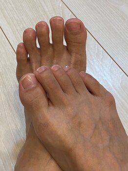 美爪ケア