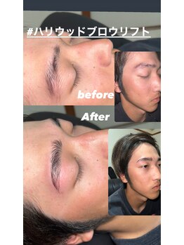 インパクト(Impact)/before after