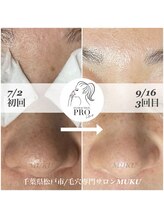 ムク(MUKU)/回数を重ねるたびもっと綺麗に