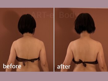 アルテ(ART-e)/Before/After 50代女性～1～
