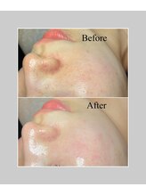 ブラックボックス(BLACK BOX)/那珂市20代のお客様