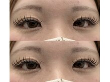 バニーアイズ 天神(Bunny eyes TENJIN)/LEDフラット180本