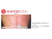 ウミノトナリ(umino TO.NA.RI.)/赤みが出にくい！