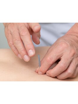 鍼灸施術を受けたい