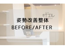 叶'エル 本町 心斎橋院/整体・小顔ビフォー・アフター等