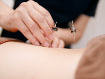 ノア鍼灸院 温灸堂(NOA鍼灸院)