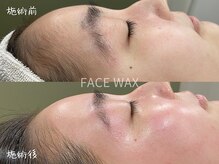 ミコサロン(miko salon)/フェイスワックス