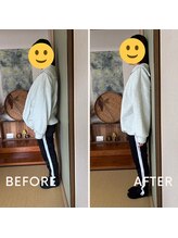 もみまつ 富山院/ビフォーアフター