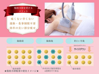 ラシーク(LASEEQ)の写真