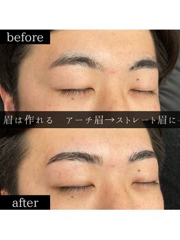 ユー 千葉駅前店(you)/ビフォーアフター写真