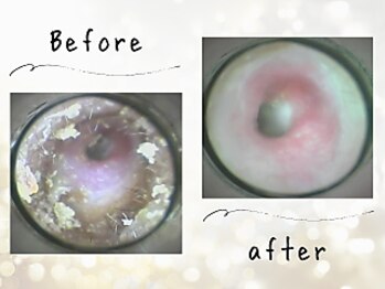 ゴート 中目黒(GOAT)/Before after