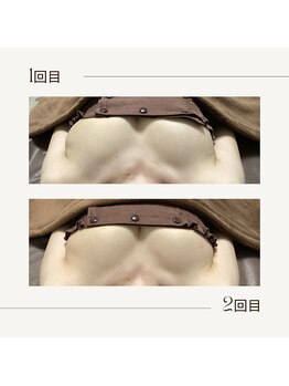 ラグレ(LUXRE)/バストケア