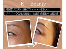 小顔ウナ学芸大学店(UNA)