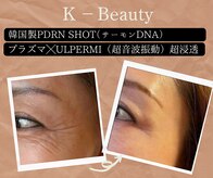 小顔ウナ学芸大学店(UNA)
