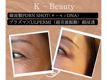 小顔ウナ学芸大学店(UNA)の写真