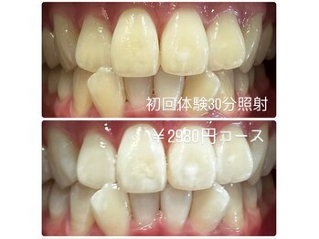 ホワイトニングルーム 横浜店(Whitening Room)/ホワイトニング/横浜