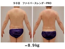 未来型スパエステ サリスパ(SARI SPA)/メンズビフォーアフター