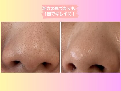 スター(Star)の写真